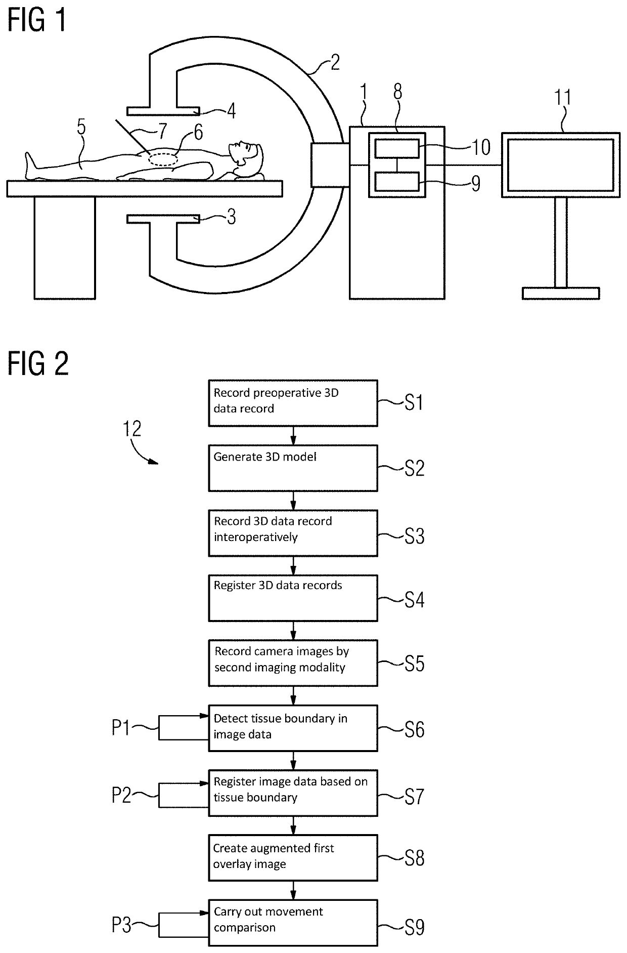 Medical imaging device, method for supporting medical personnel, computer program product, and computer-readable storage medium