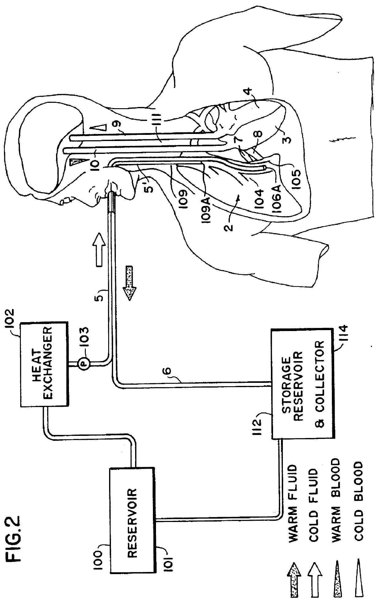 Apparatus and method for the rapid induction of hypothermic brain preservation