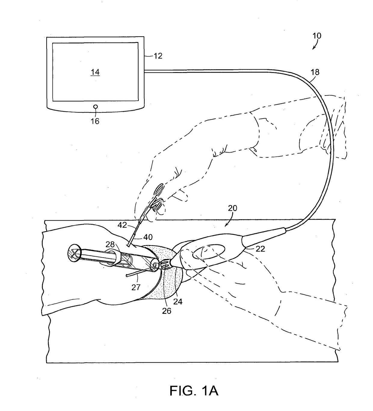 Devices and methods for minimally invasive surgery