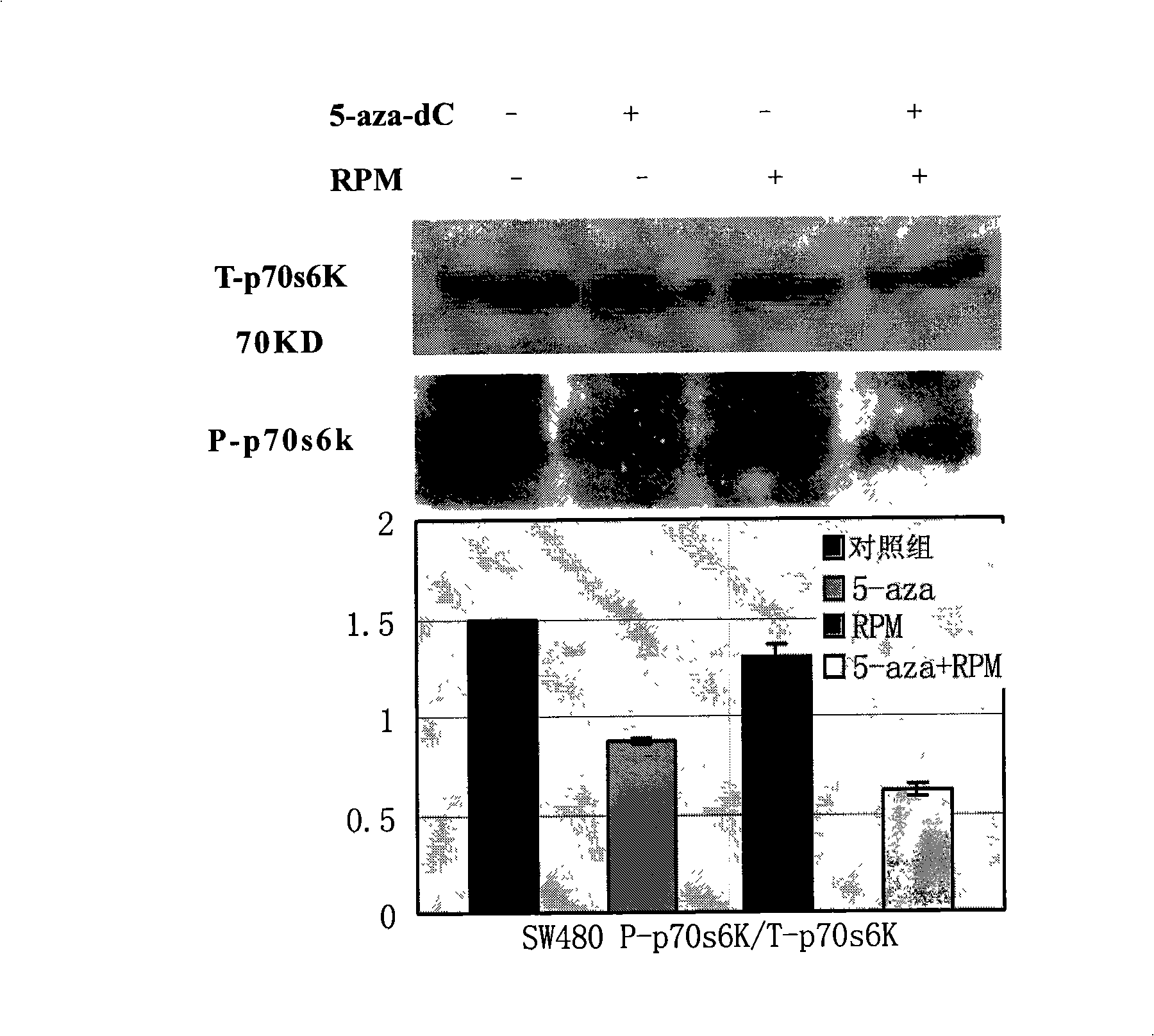 Pharmaceutical composition for treating large intestinal cancer
