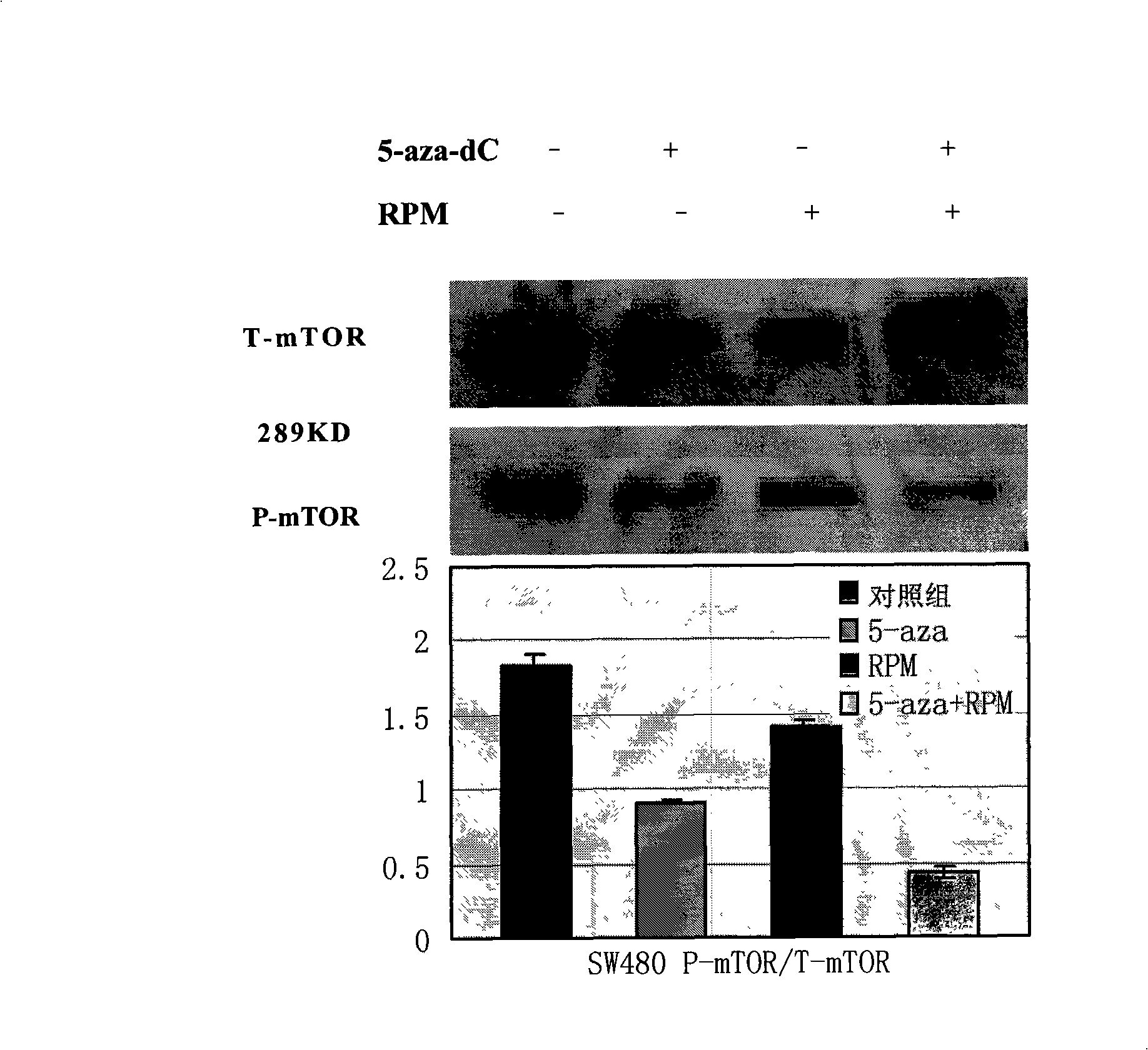 Pharmaceutical composition for treating large intestinal cancer