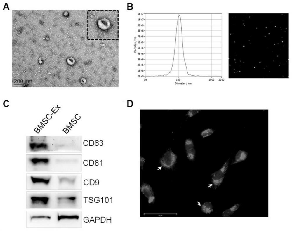 Application of exosome derived from mesenchymal stem cells in preparation of medicine for treating acute lung injury caused by sulfur mustard