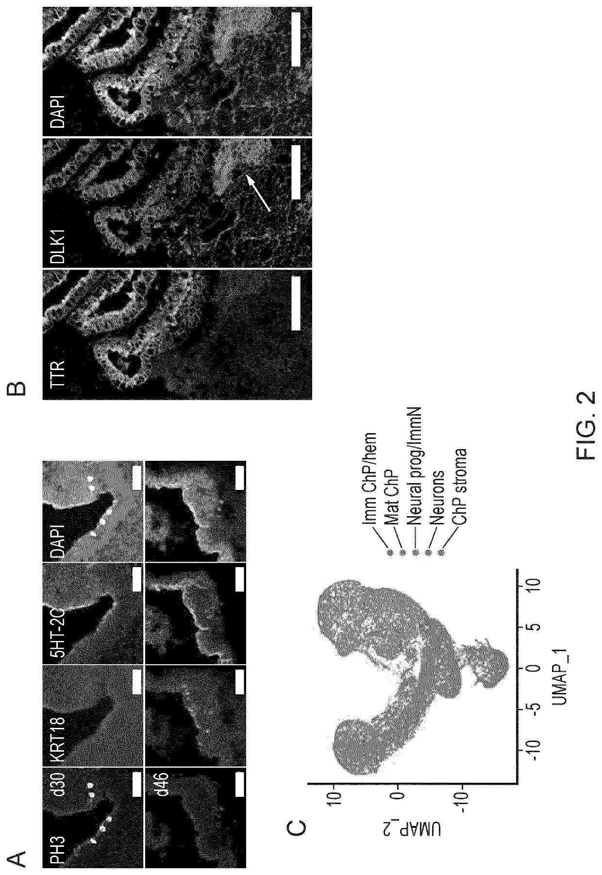 Choroid plexus organoids and methods for production thereof