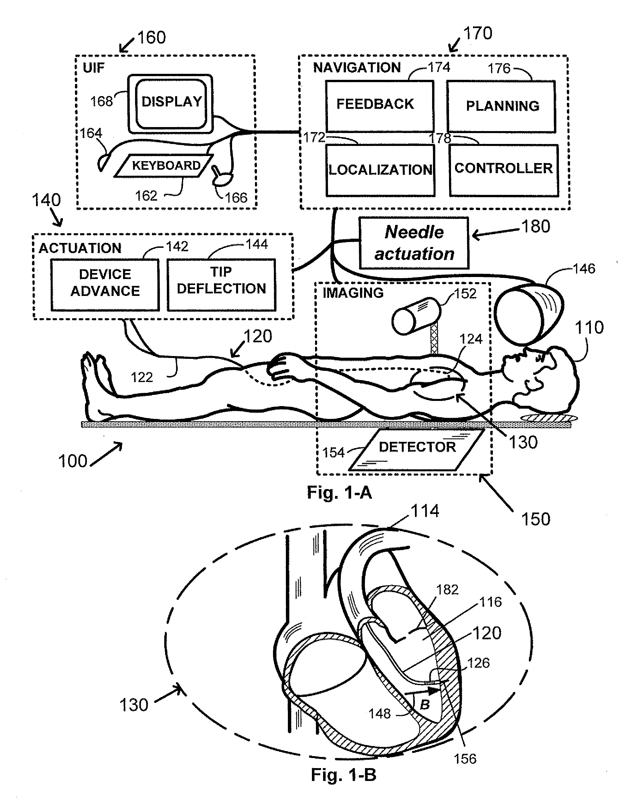 Method and apparatus for intra-chamber needle injection treatment