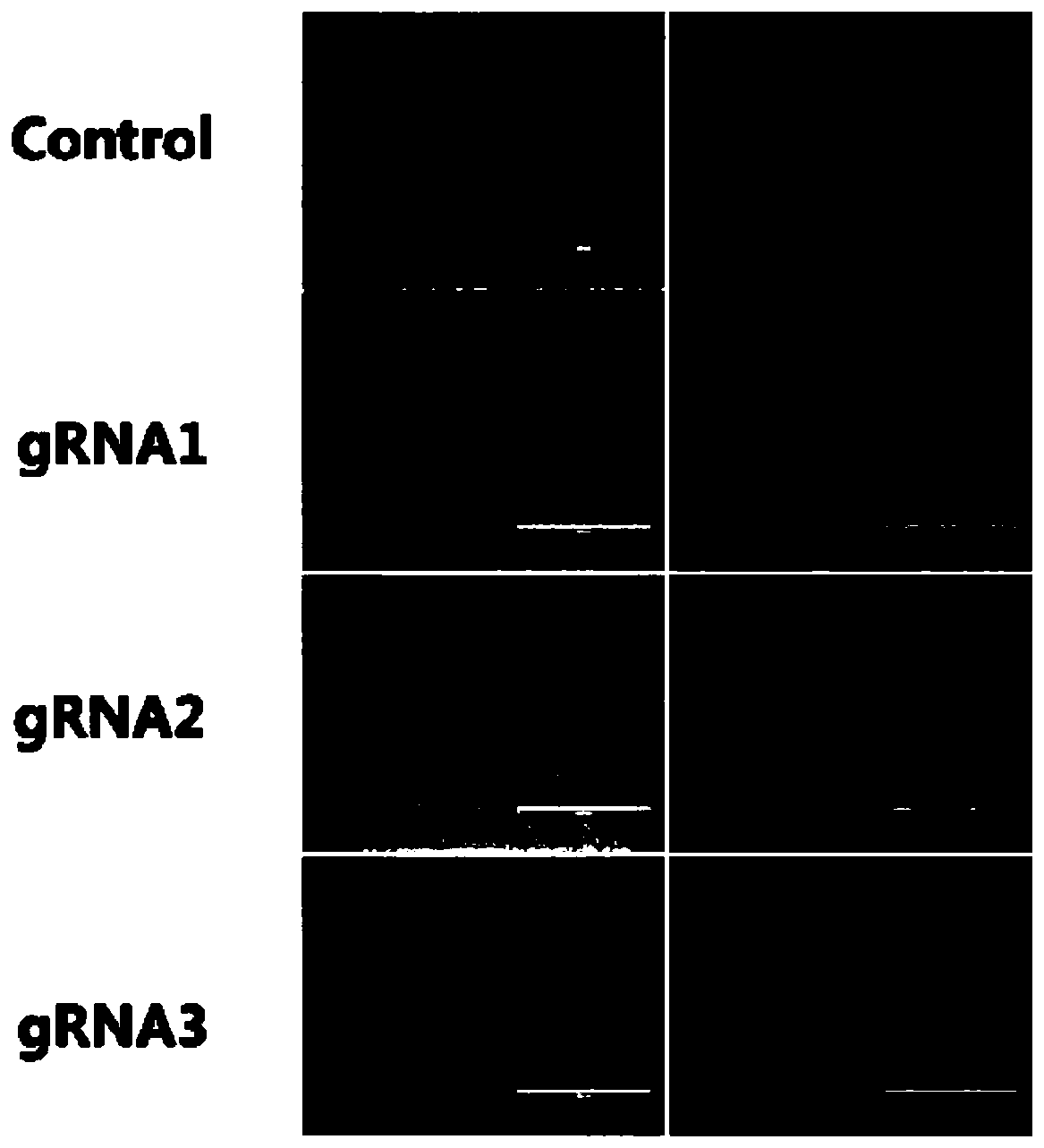 SgRNA for specific recognition of pig KIT gene, coding DNA thereof and kit, and application thereof