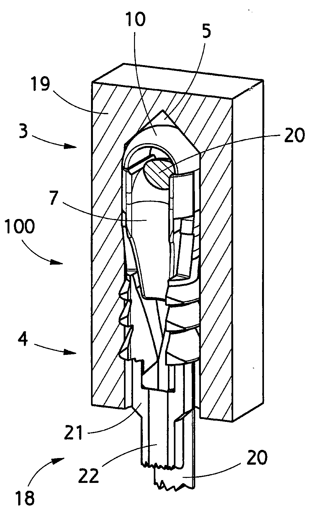 Implant and use thereof