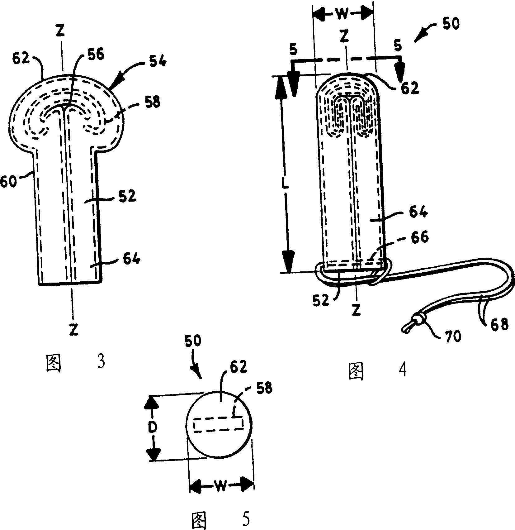 Method for alleviating female urinary incontinence