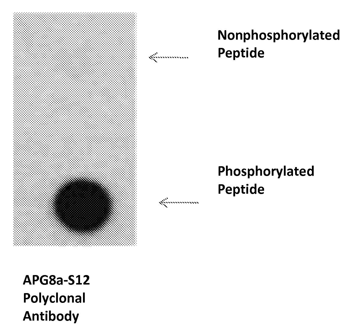 Regulation of apg8 phosphorylation and uses thereof