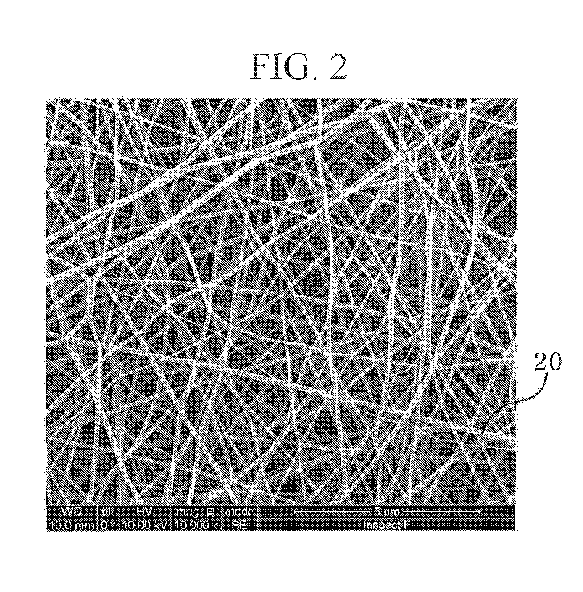 Separation membrane for water treatment and manufacturing method thereof