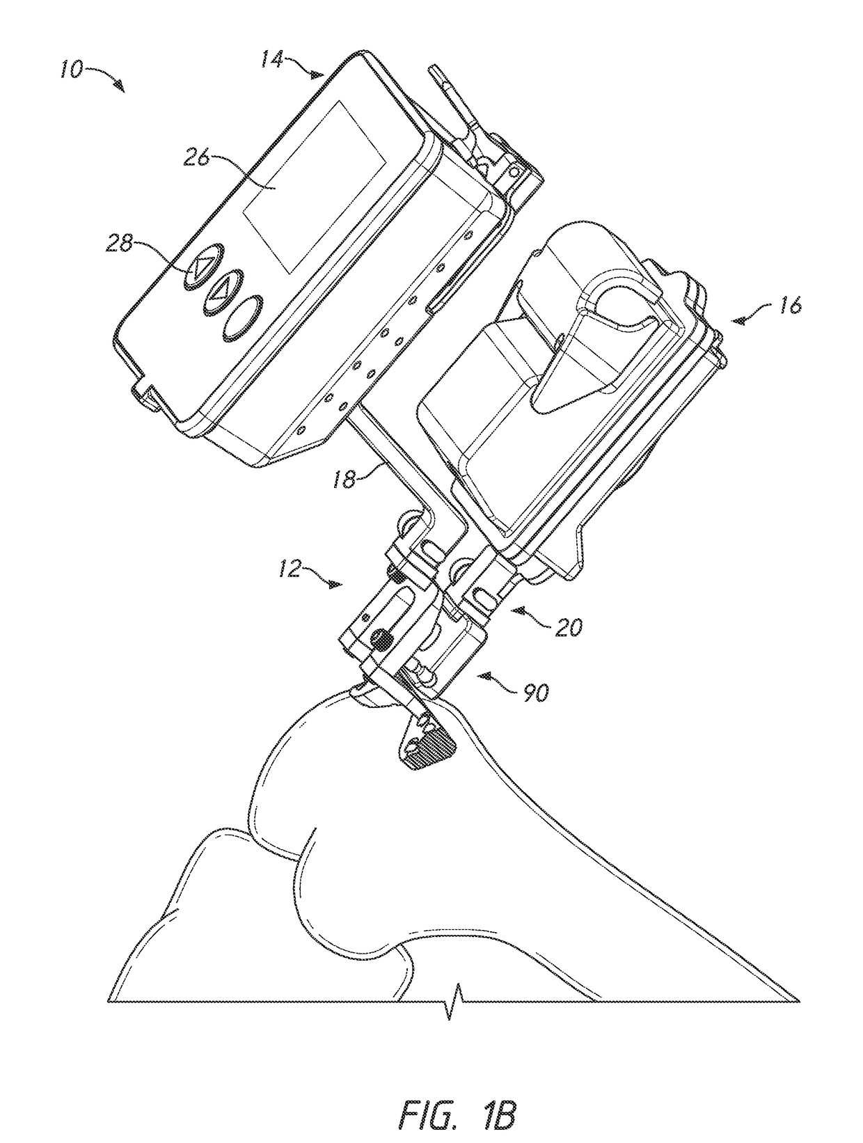 Soft tissue measurement & balancing systems and methods