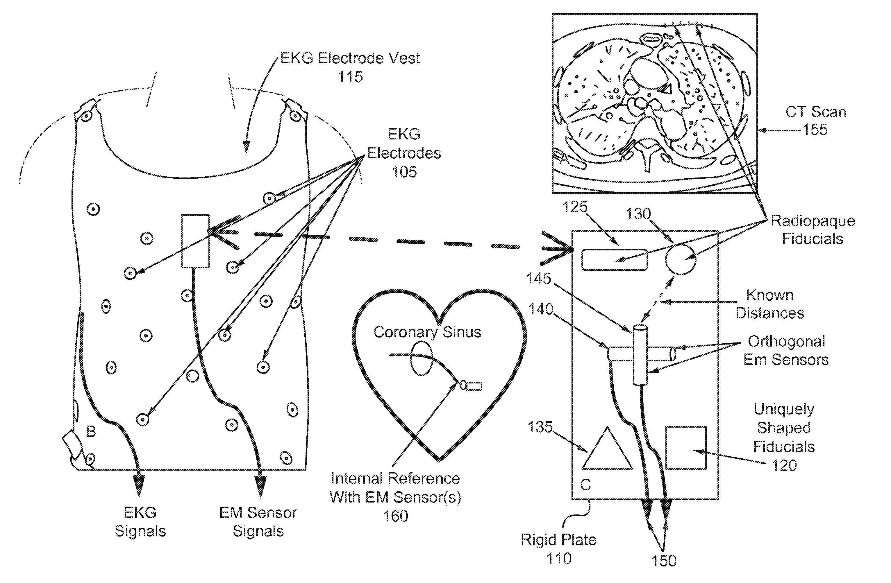 System and methods for using body surface cardiac electrogram information combined with internal information to deliver therapy