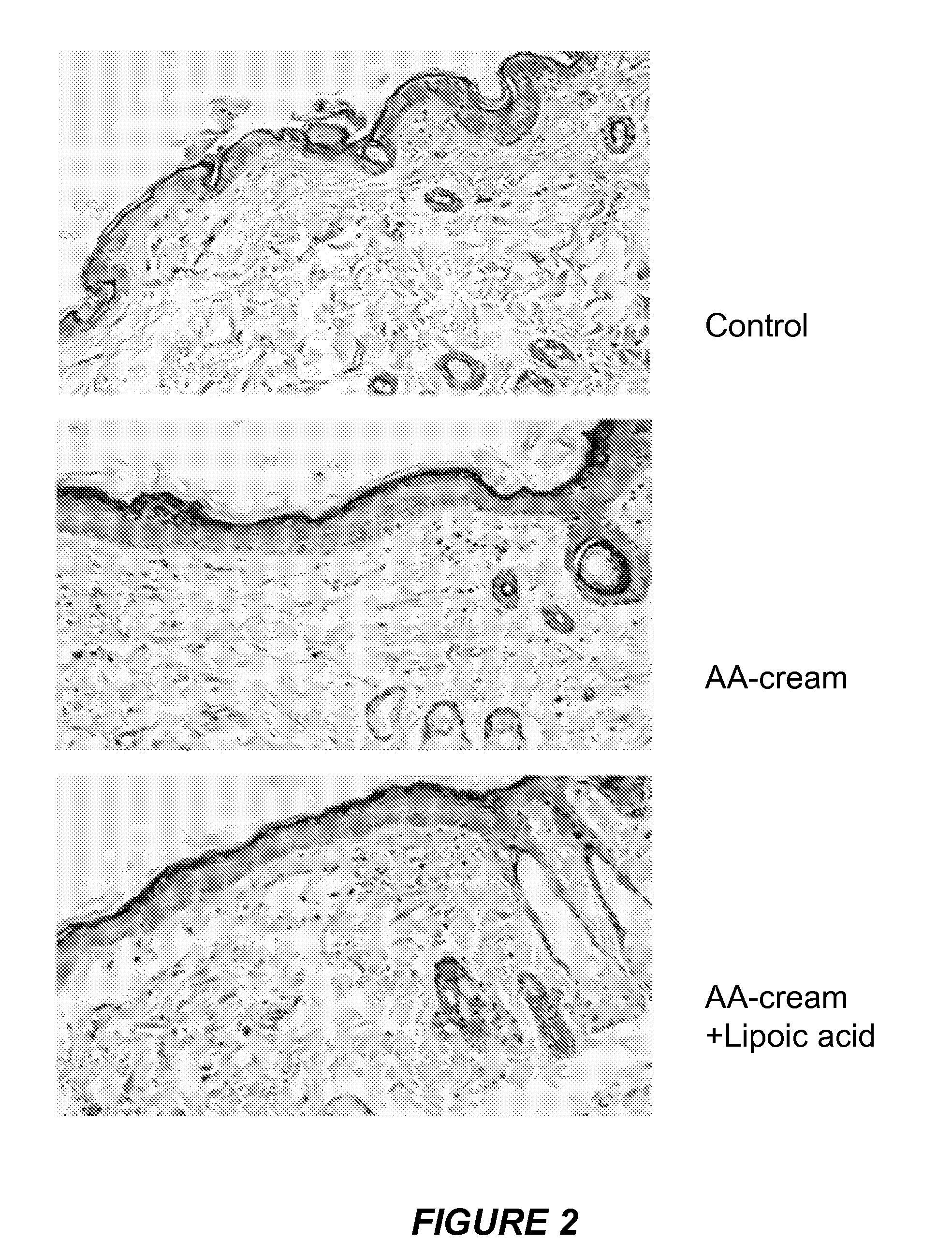 Methods and compositions for enhancing collagen, proteoglycan, and glutathione synthesis in the skin