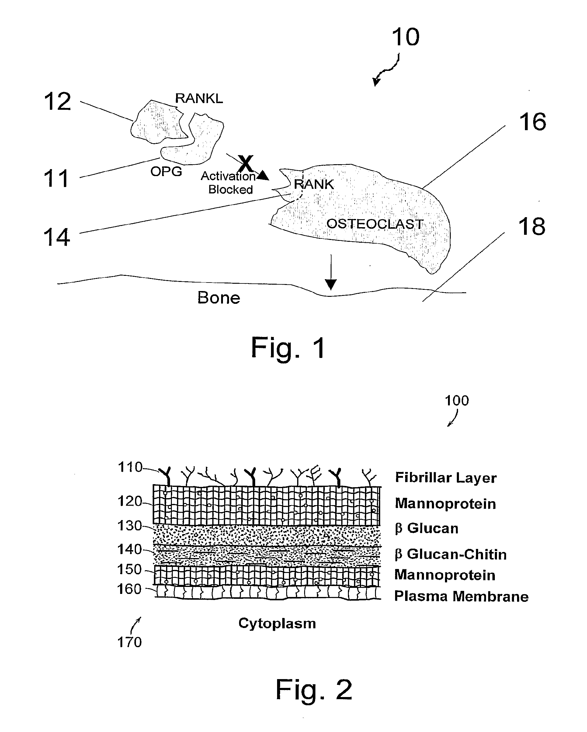 Compositions and their uses for gene therapy of bone conditions