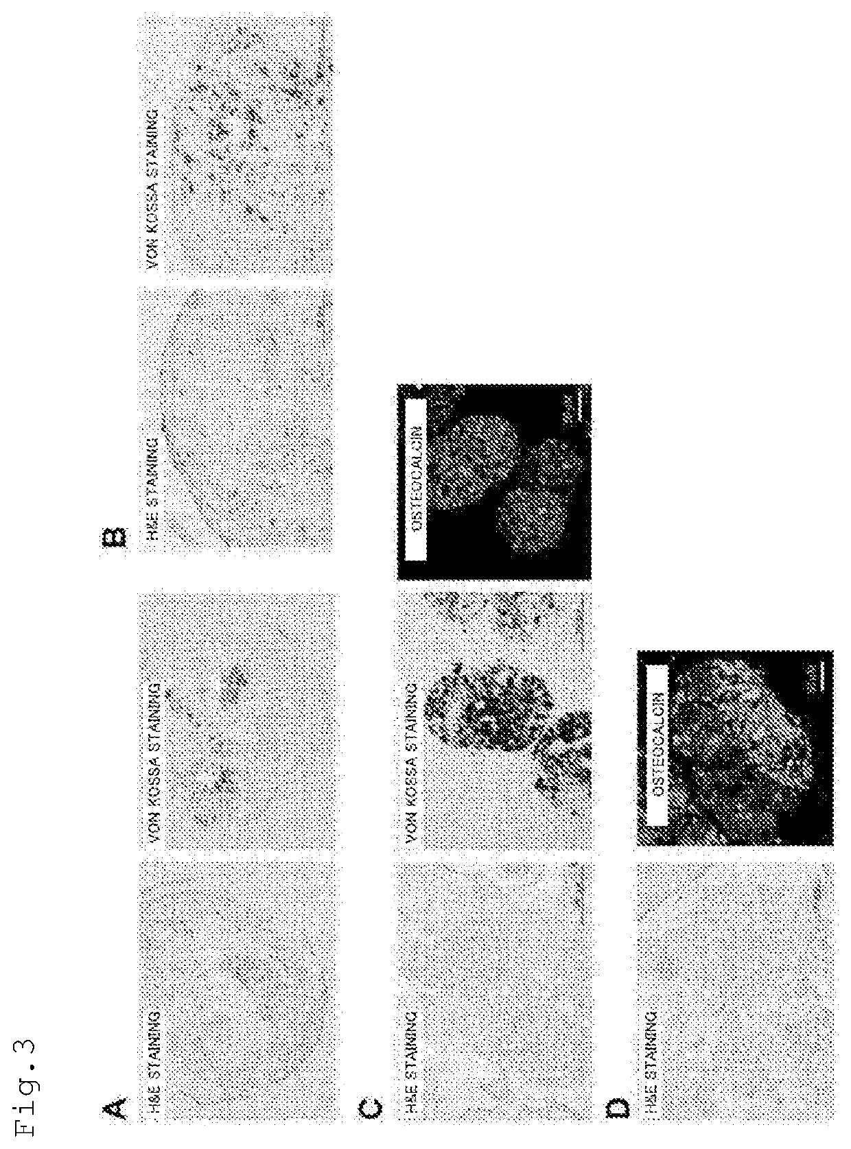 METHOD FOR PRODUCING OSTEOBLAST CLUSTER USING HUMAN iPS CELLS