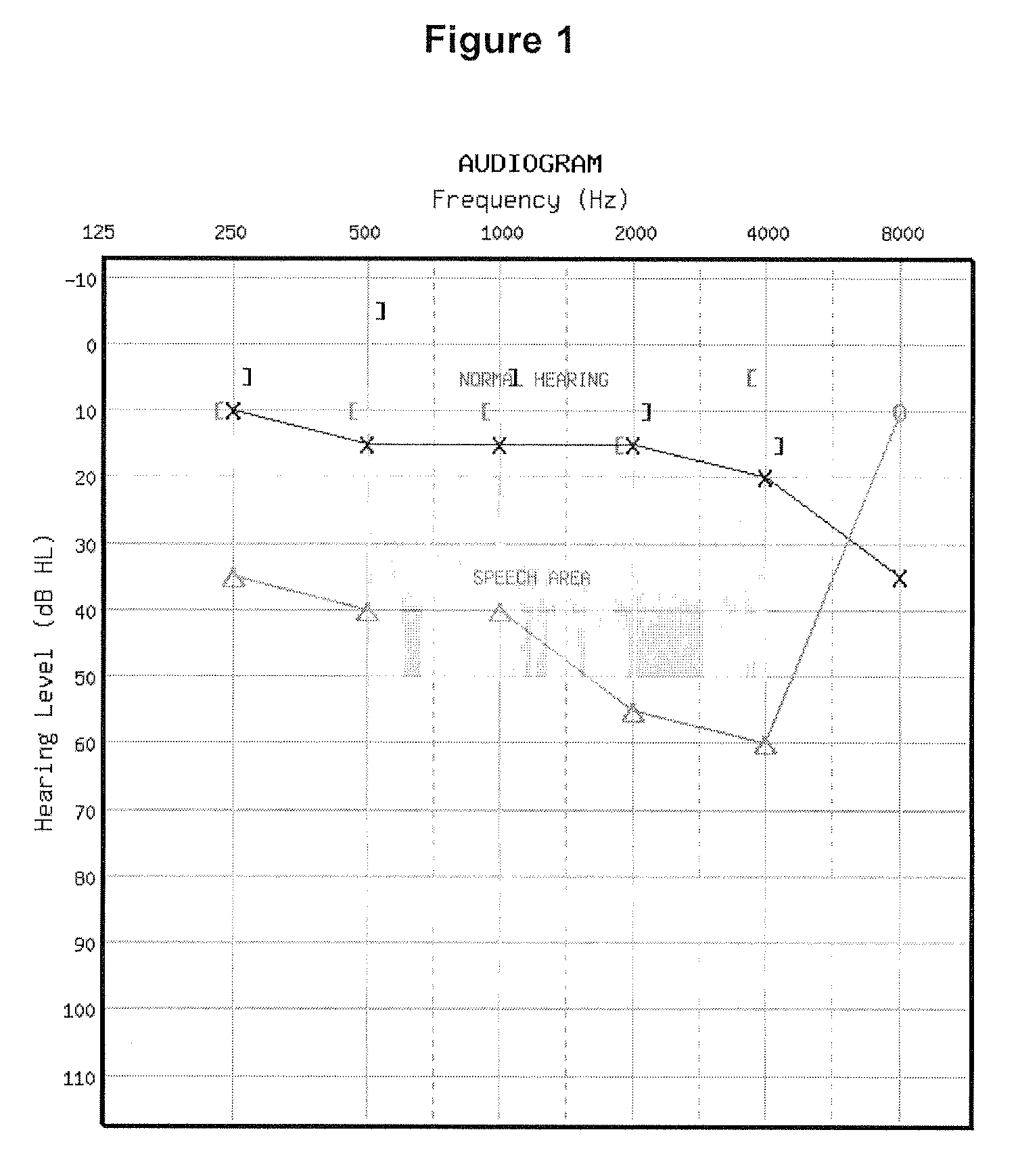 Audiogram classification system