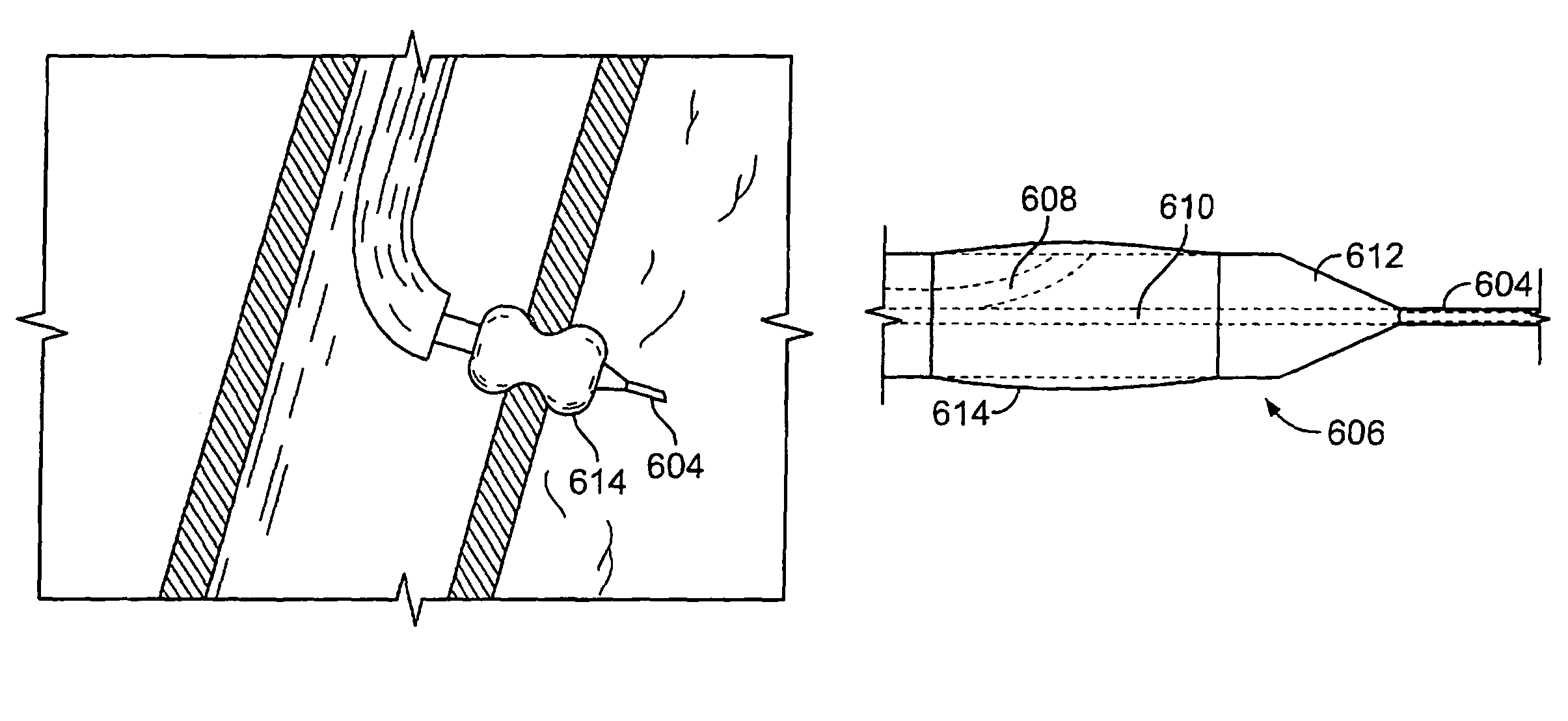 Devices for maintaining patency of surgically created channels in tissue