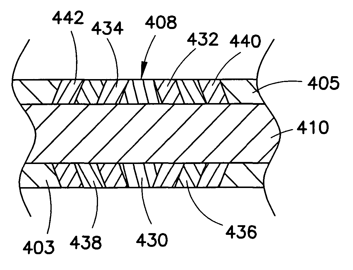 Dynamic spinal stabilization device and systems