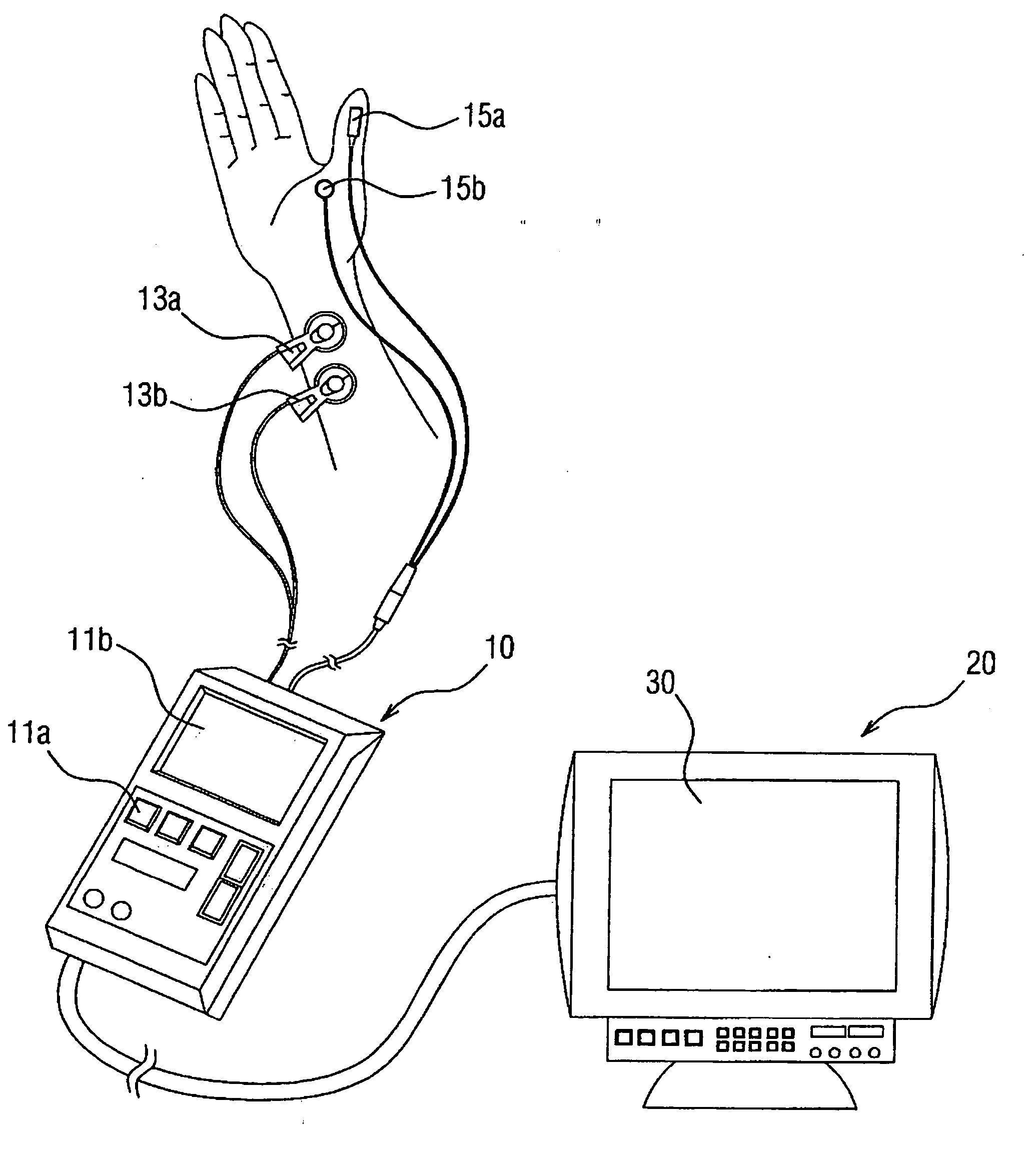Method and monitor apparatus for displaying parameters indicative of muscle relaxation