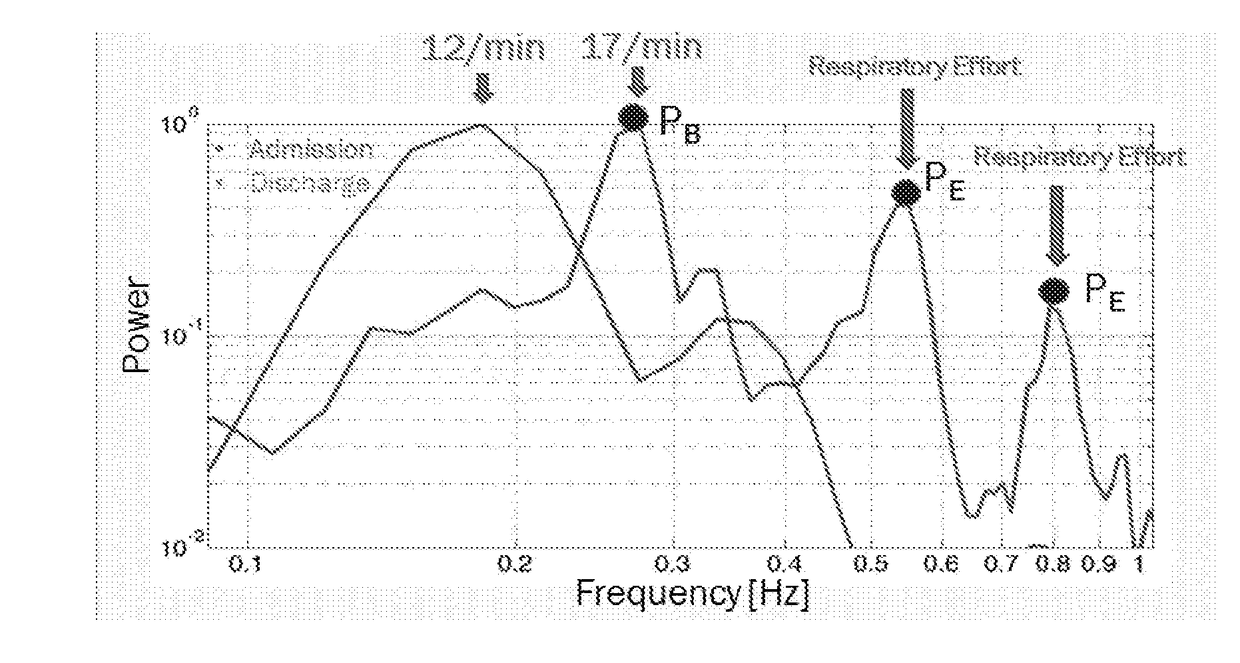 Method device and system for monitoring sub-clinical progression and regression of heart failure