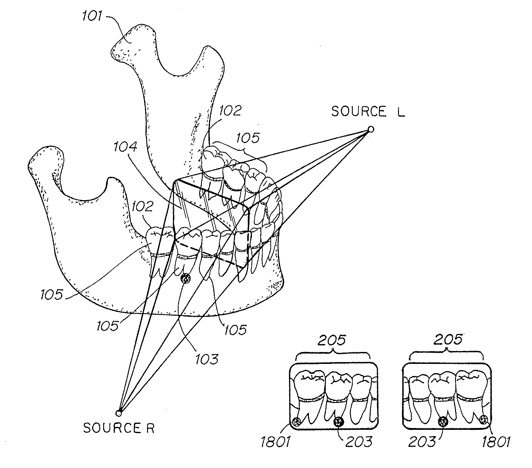 Radiation sensitive recording plate with orientation identifying marker, method of making, and of using same