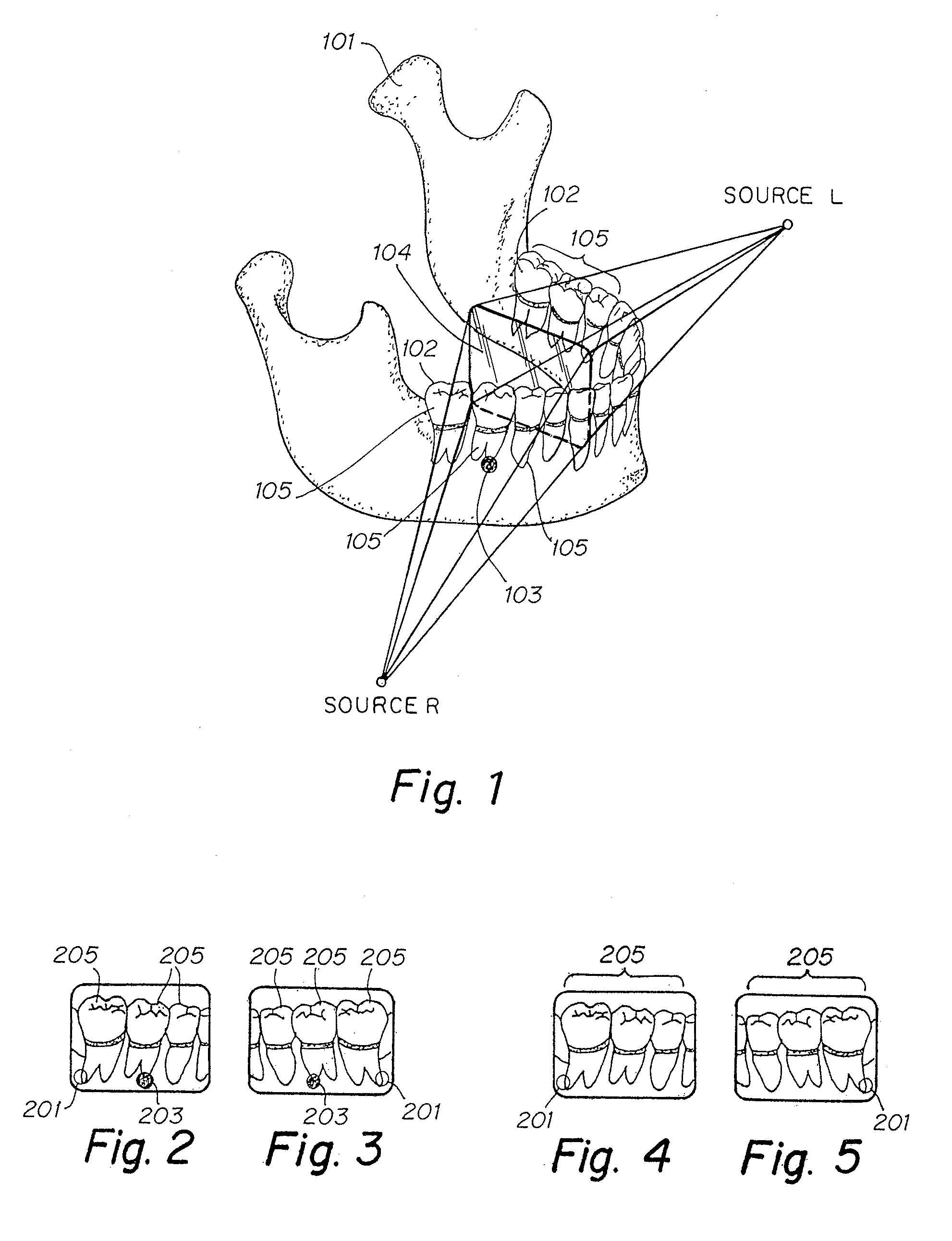 Radiation sensitive recording plate with orientation identifying marker, method of making, and of using same