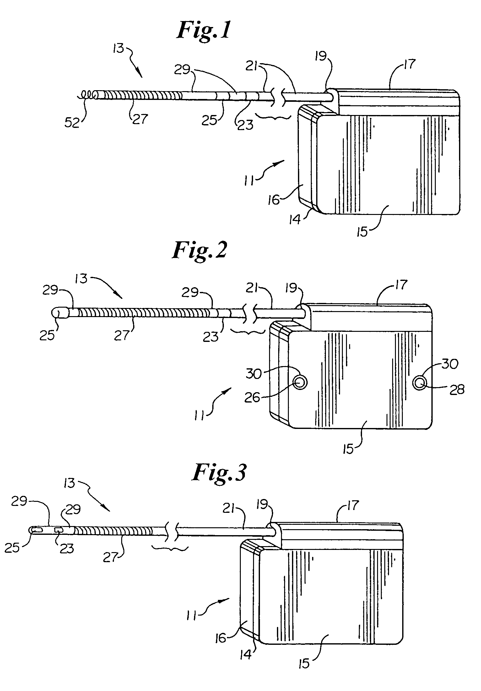 Duckbill-shaped implantable cardioverter-defibrillator canister and method of use