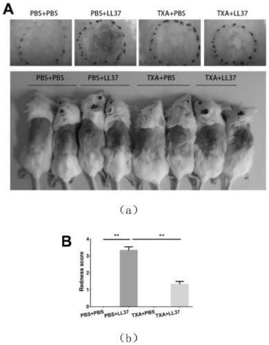 Medicine for improving symptoms of acne rosacea, animal model of medicine and construction method of animal model