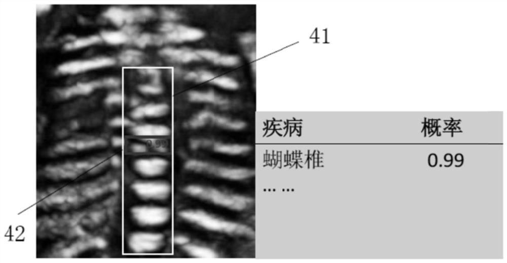 Ultrasonic imaging device