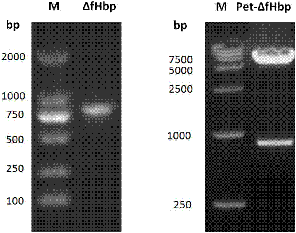 Human epidemic cerebrospinal meningitis-pneumococcus combined vaccine and preparation method thereof