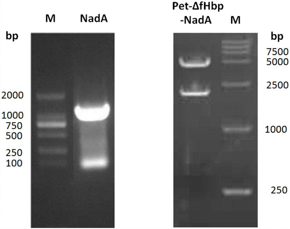 Human epidemic cerebrospinal meningitis-pneumococcus combined vaccine and preparation method thereof