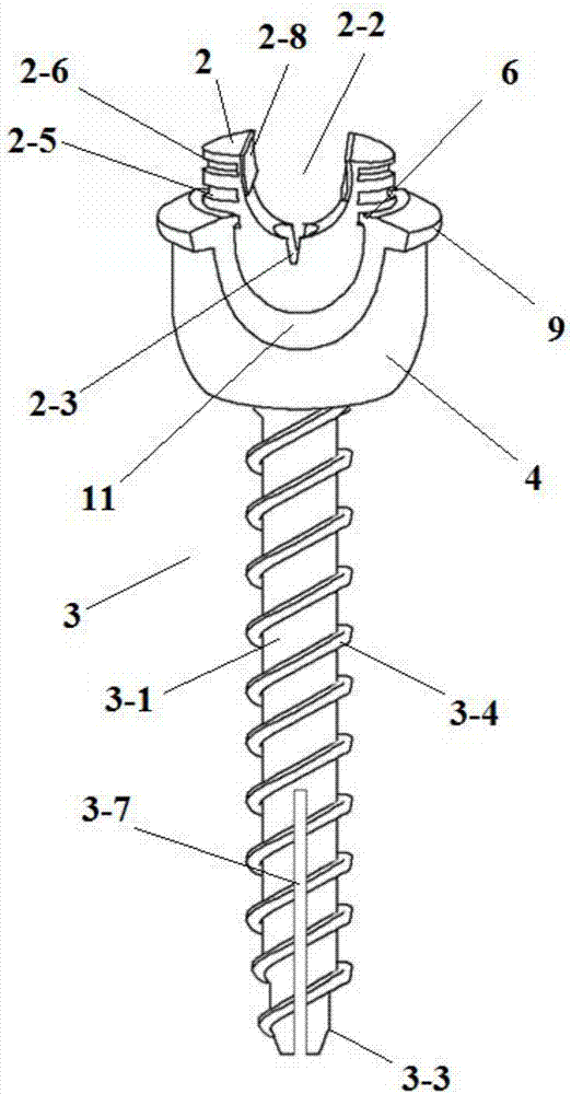 Lifting locking type polyaxial pedicle screw