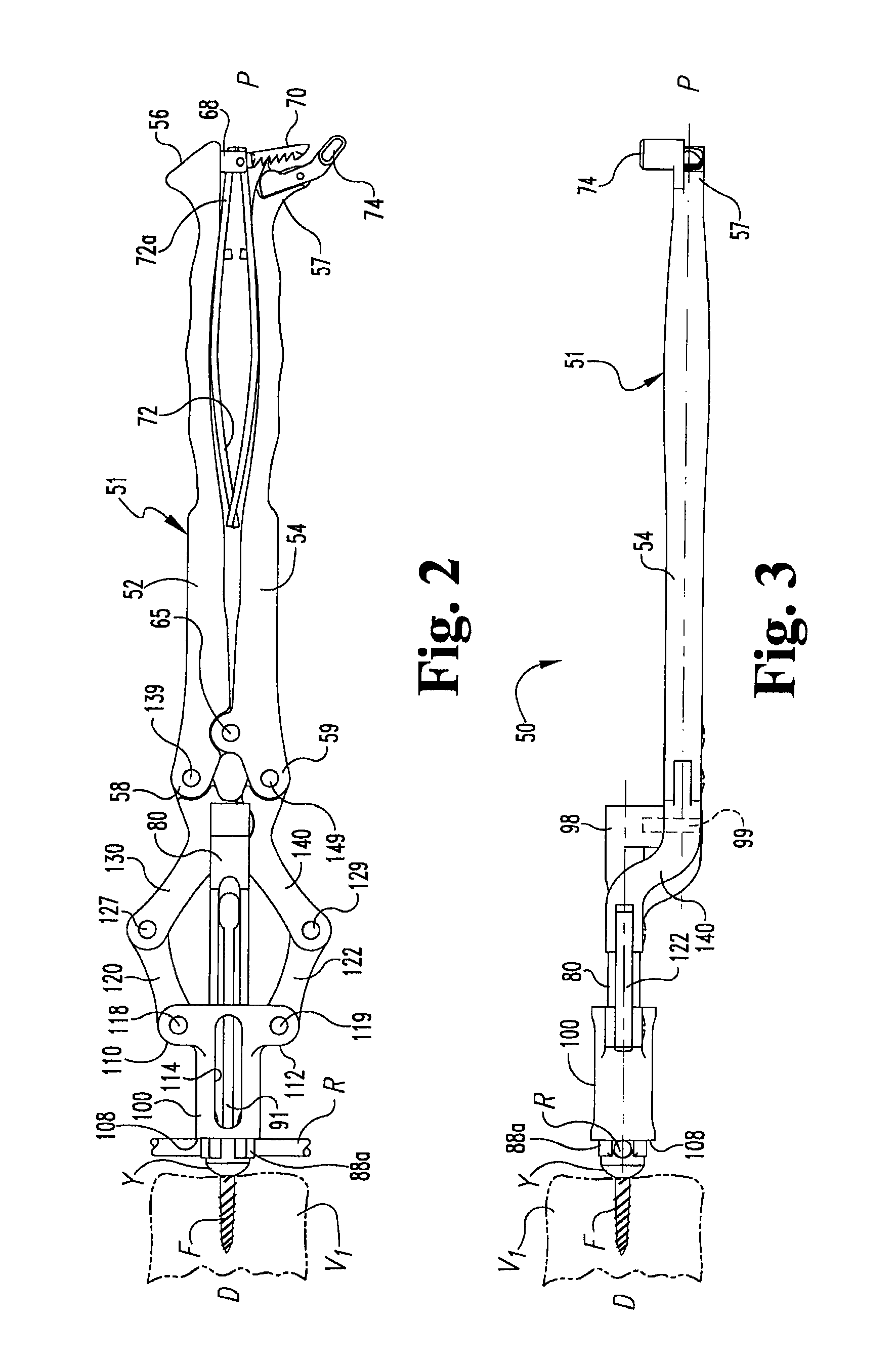Rod reducer instruments and methods