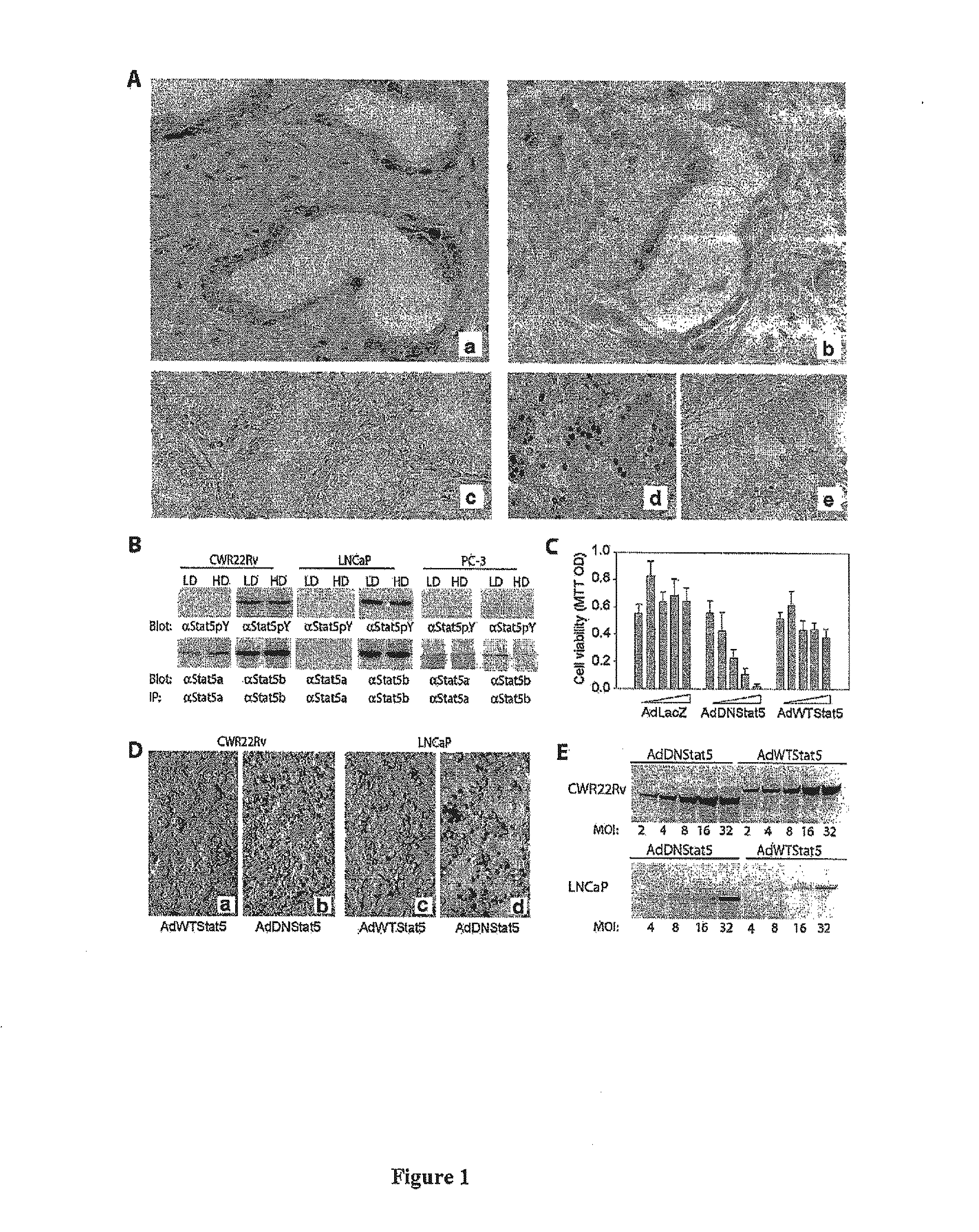 Methods and compositions for the inhibition of stat5 in prostate cancer cells