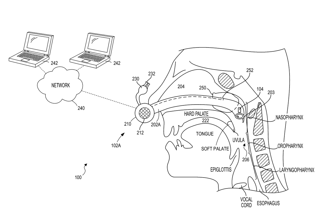 Systems, methods and devices for diagnosing sleep apnea