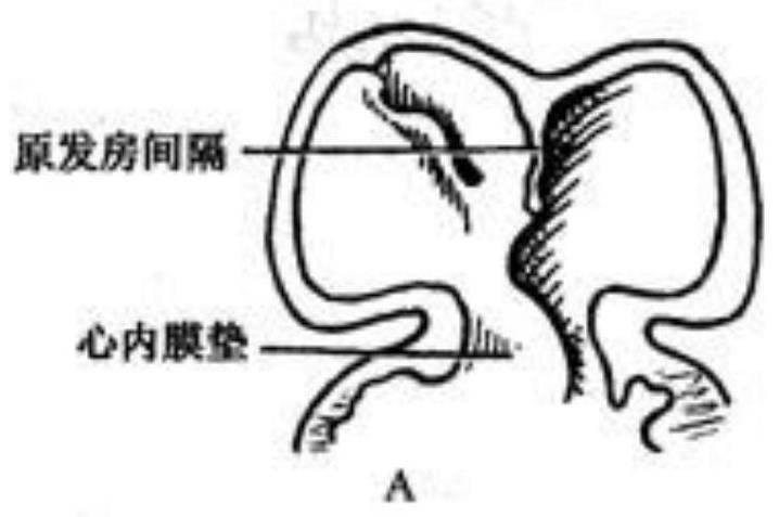 Device suitable for patent foramen ovale patient