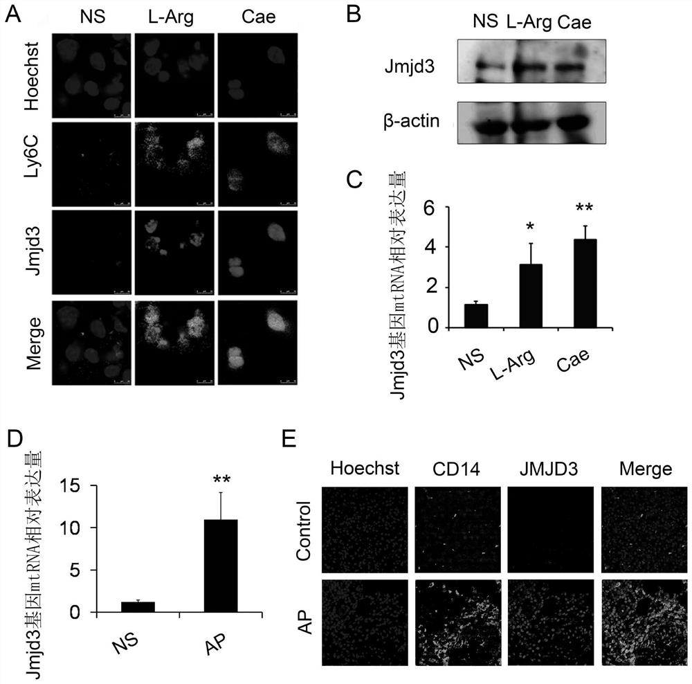 Use of jmjd3 inhibitors in the preparation of medicines for preventing and treating pancreatitis