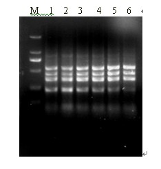 Multiple RT-PCR (reverse transcription-polymerase chain reaction) detection method for SPVD (sweet potato virus disease)