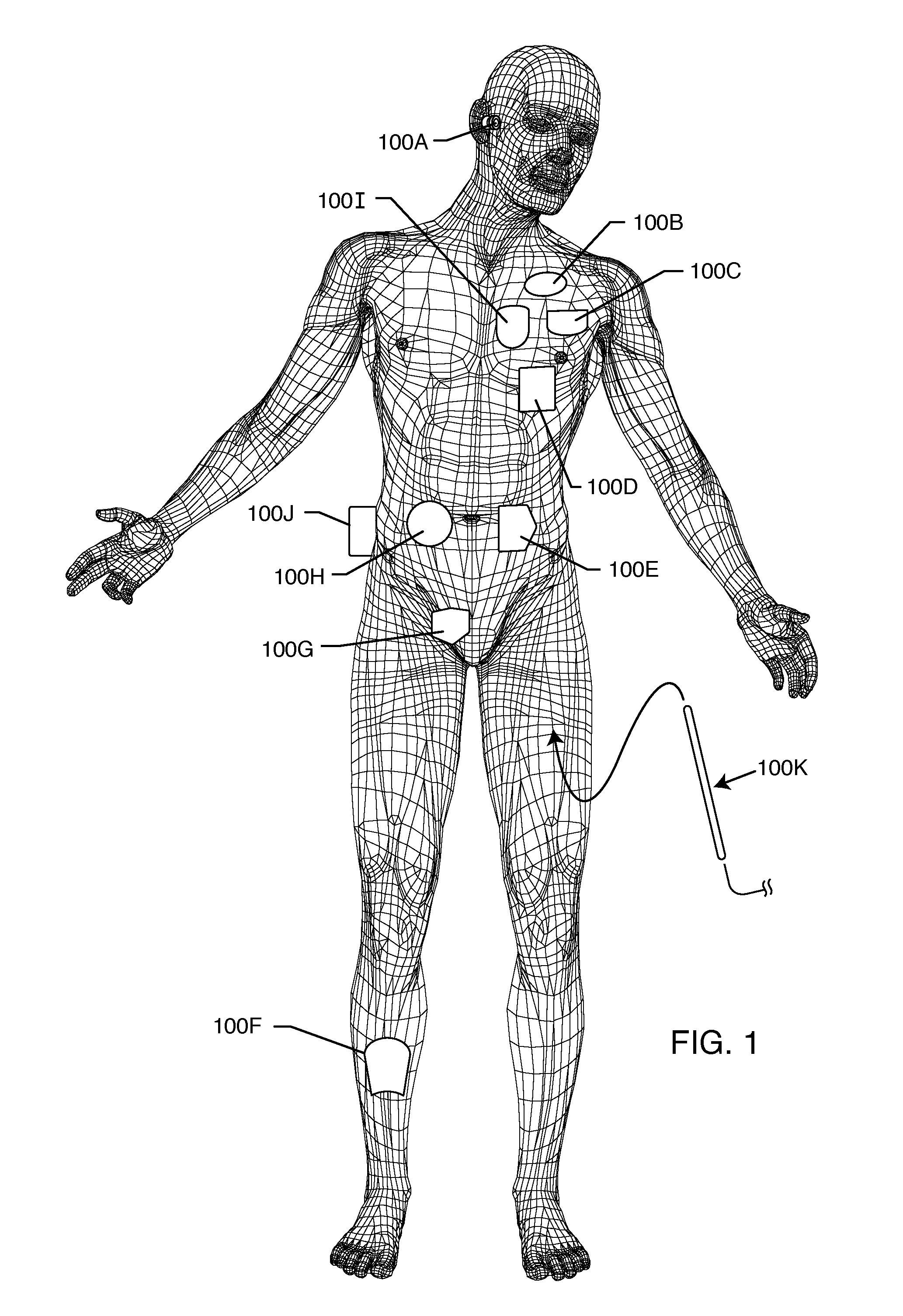 Implantable lead bandstop filter employing an inductive coil with parasitic capacitance to enhance MRI compatability of active medical devices