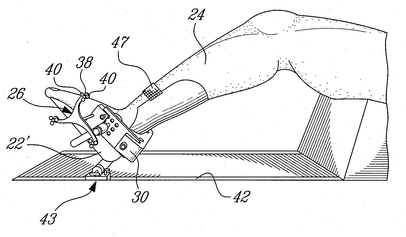 Trackable reference device for computer-assisted surgery