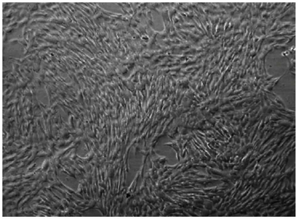 Application of exosome in promotion of growth of mesenchymal stem cells of decidua parietalis