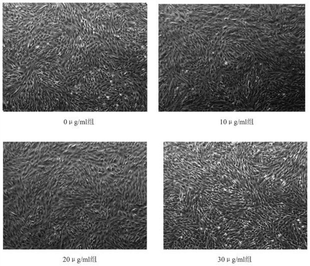 Application of exosome in promotion of growth of mesenchymal stem cells of decidua parietalis
