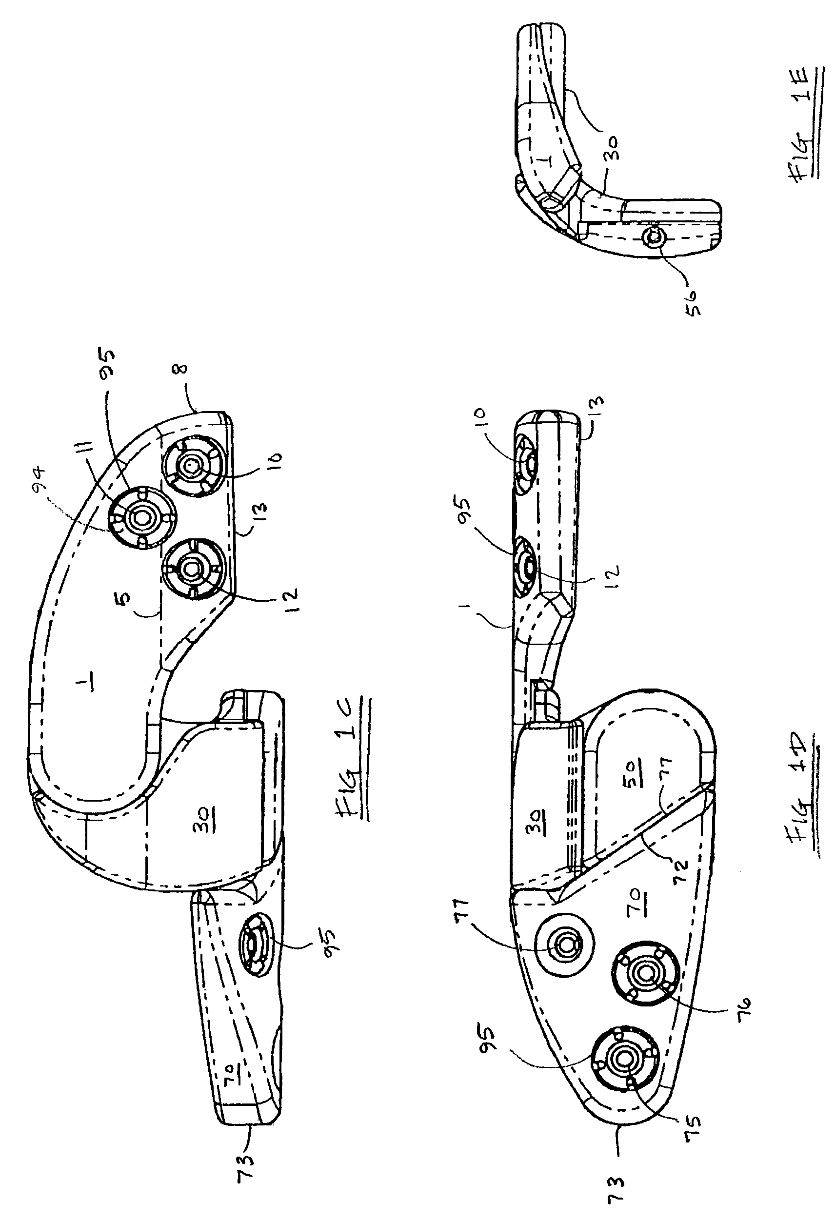 Apparatus for dynamic external fixation of distal radius and wrist fractures