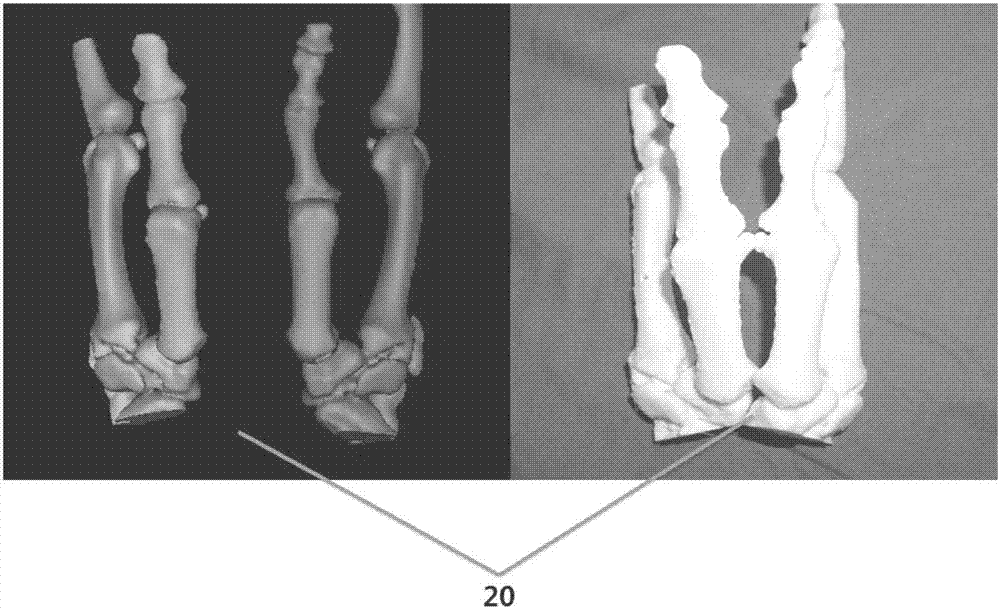 Preparing method of finger phalanx skeleton thickening shaping bone block model