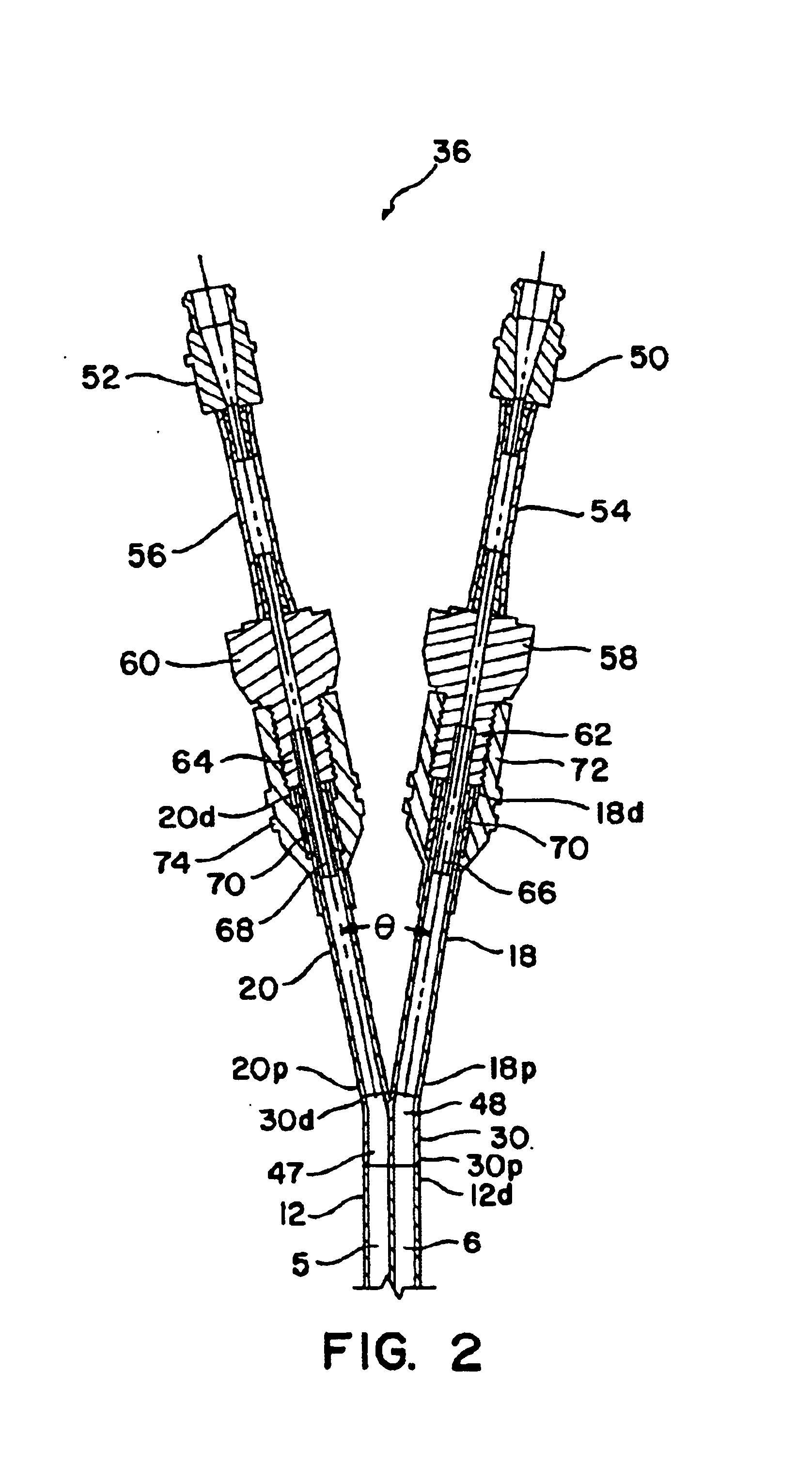 Double-y-shaped multi-lumen catheter with selectively attachable hubs