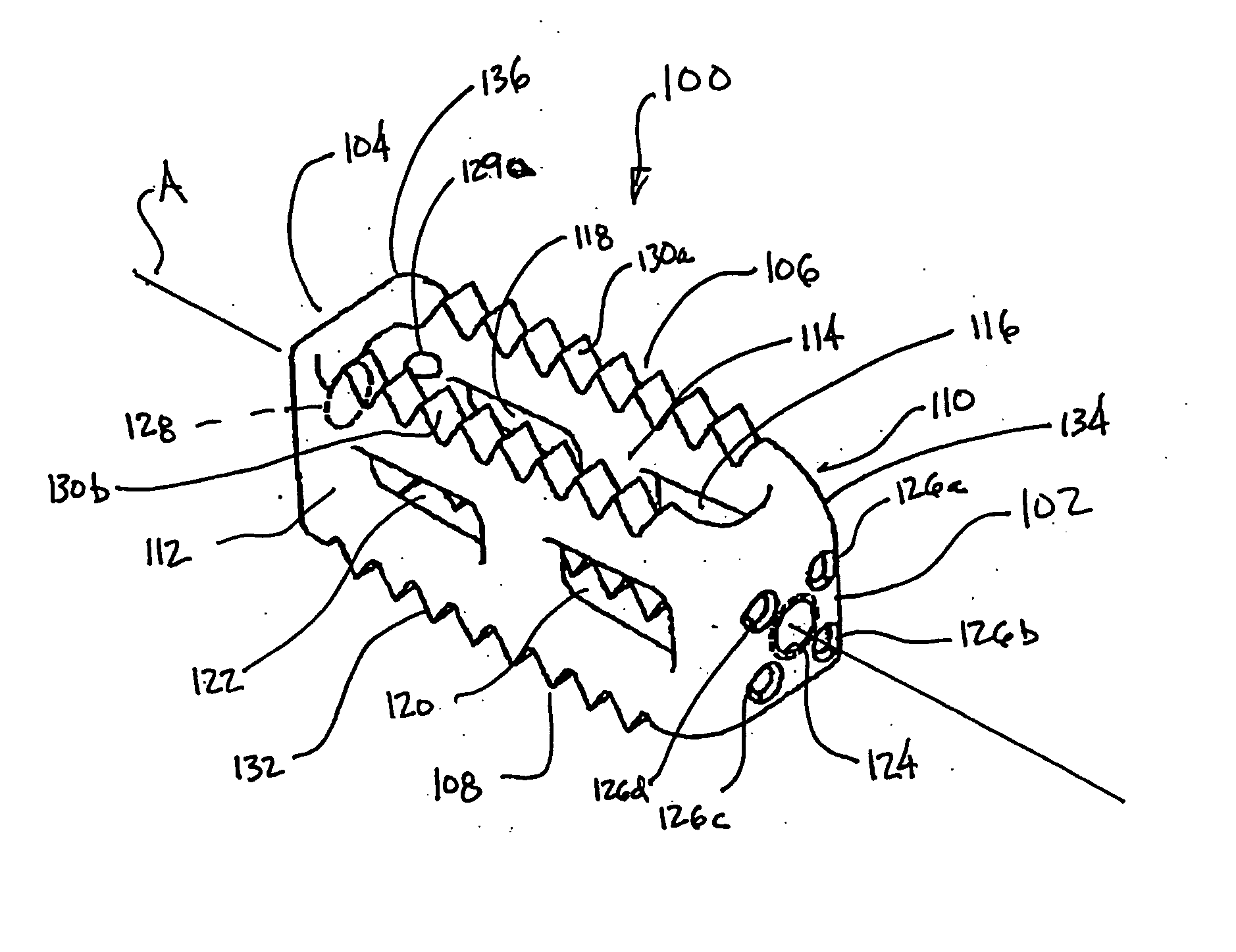 Prosthetic implant, and a method and tool for the insertion of same