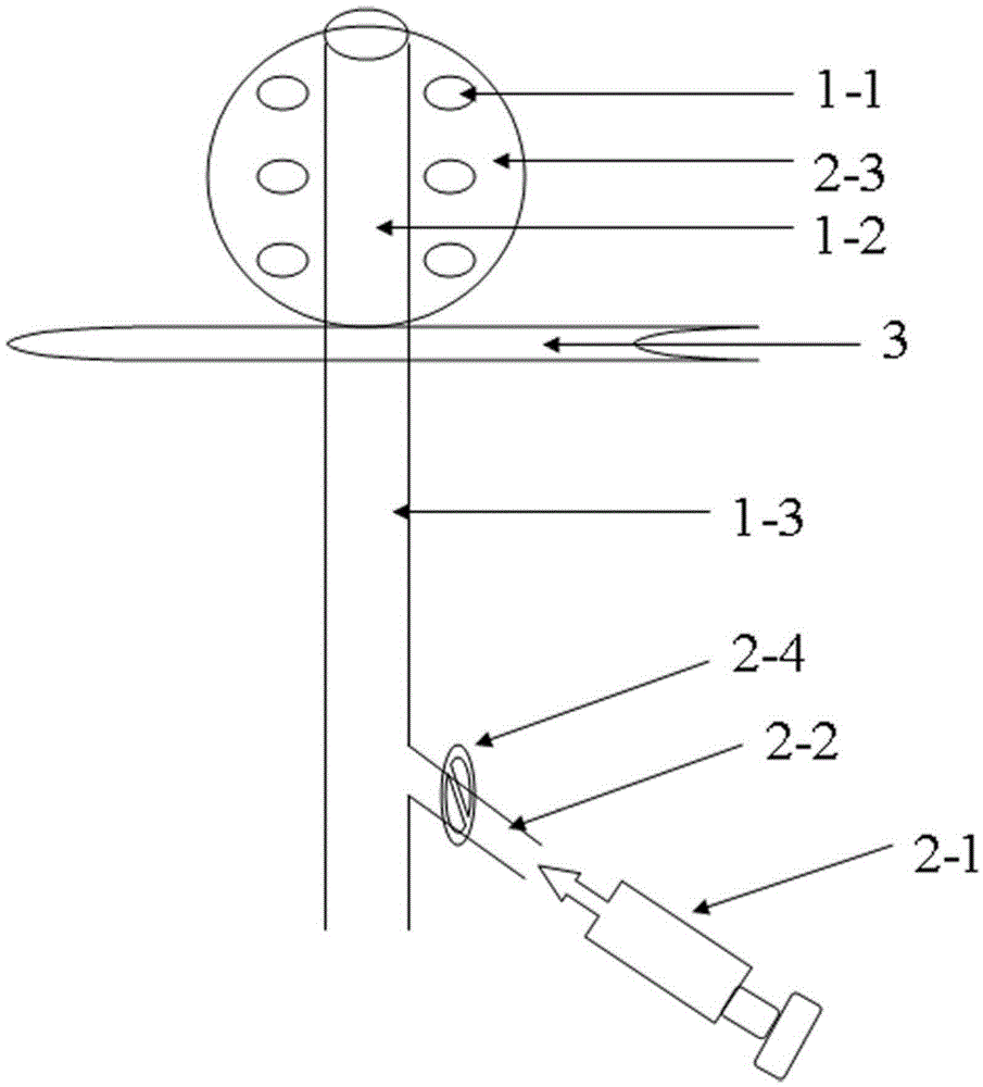 Subcutaneous inflatable drainage support frame