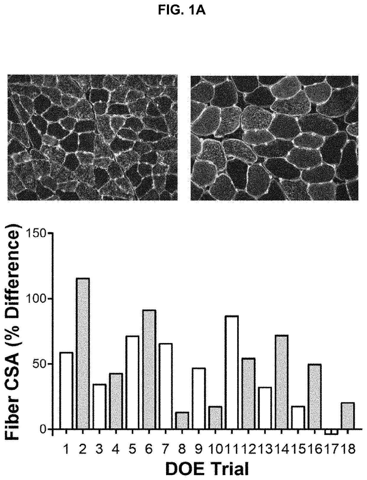 Novel nutrients to enhance load-induced muscle hypertrophy