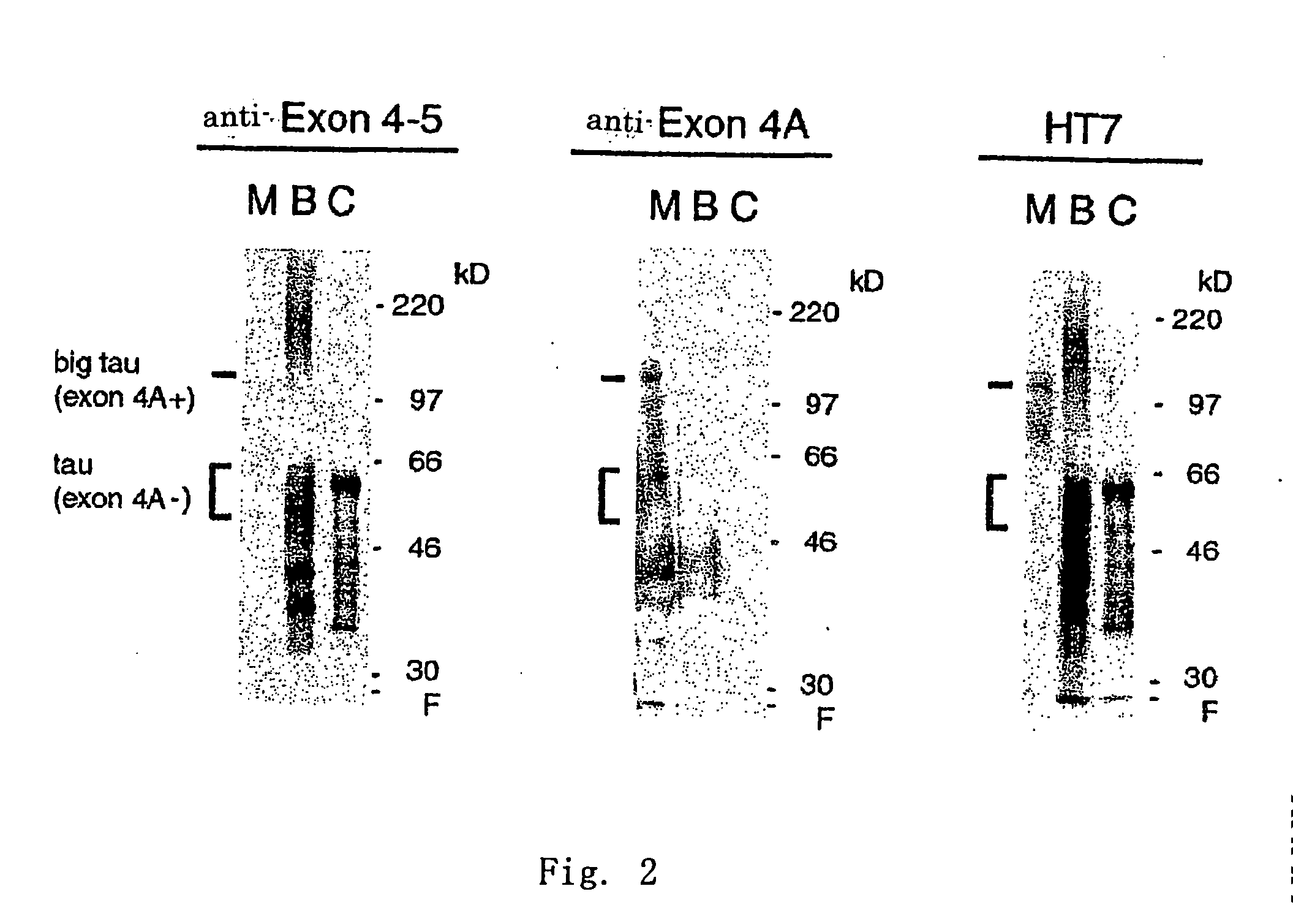 Antibody specific to central nervous system tau protein