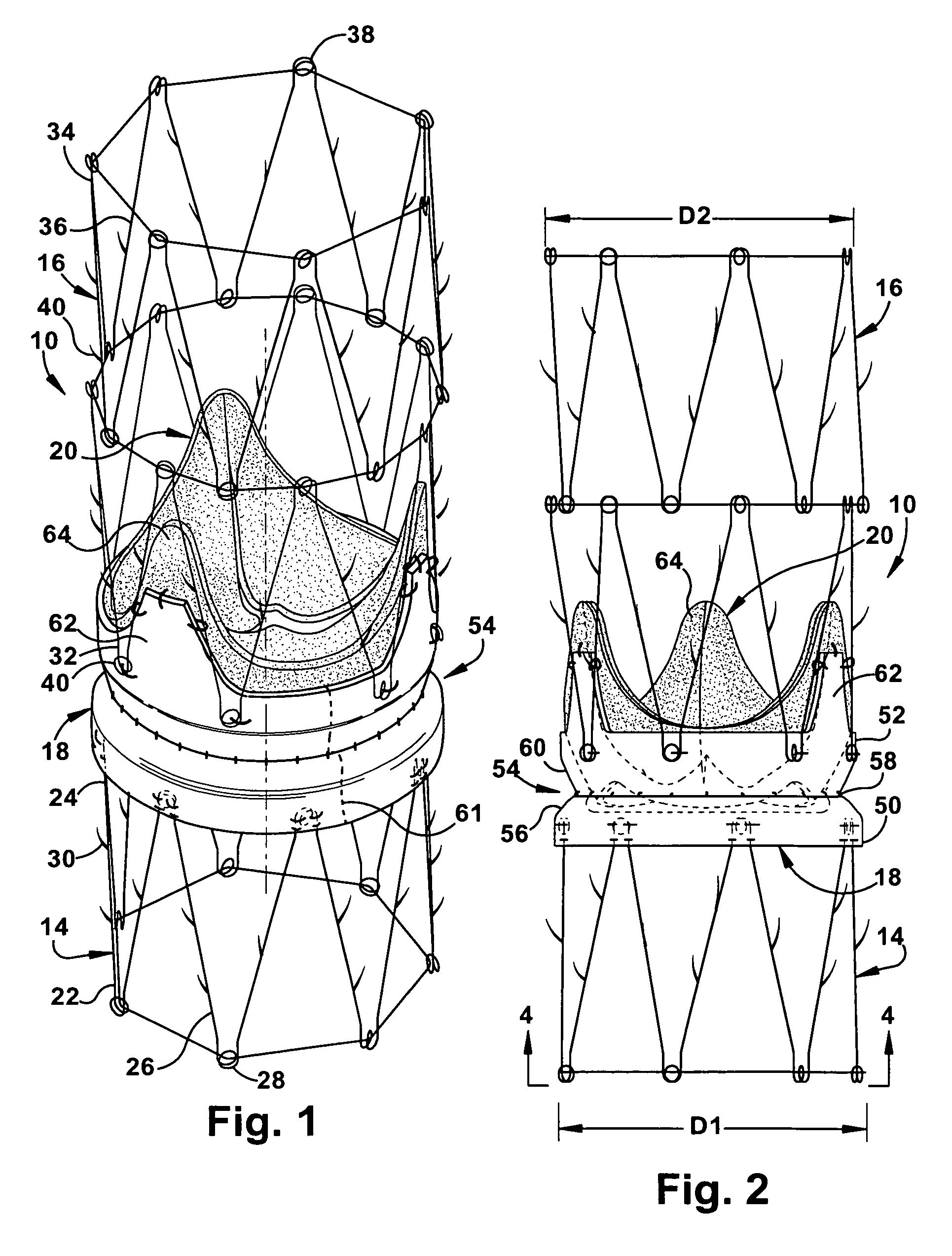 Apparatus and methods for repairing the function of a diseased valve and method for making same