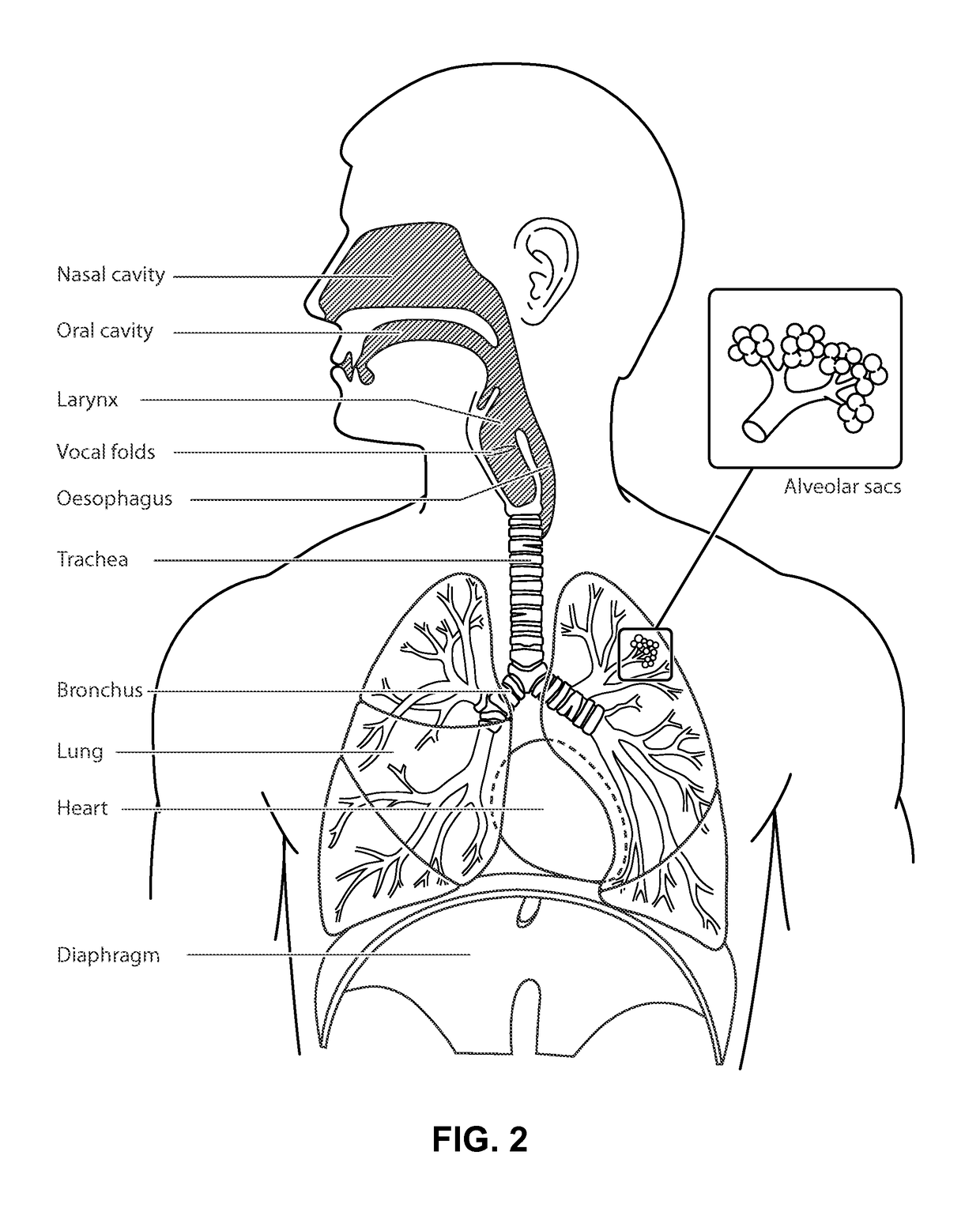 Self-optimising respiratory therapy system